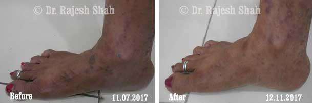 lifeforce homeopathy case-photos